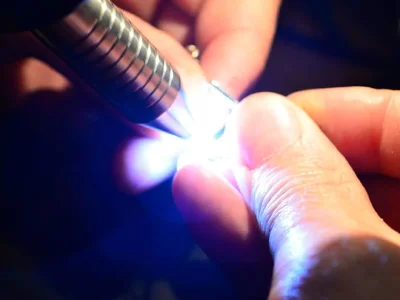 сваривание лазерным аппаратом